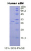 Human Recombinant Alpha-2-Macroglobulin (a2M)